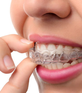 woman removing clear Invisalign aligner