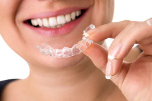 young woman holding invisalign tray