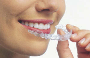 woman inserting her Invisalign clear aligner after cleaning it at home