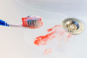 bloody toothbrush in the sink after flossing bloody gums